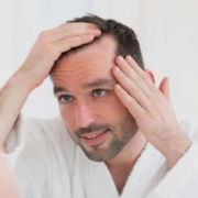 mens hair loss royal-oak mi