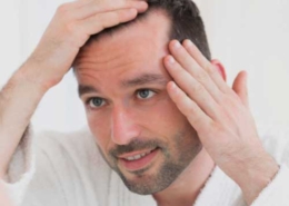 mens hair loss royal-oak mi
