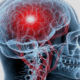 hrt hormone therapy oakland county